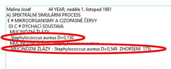 Ukázka postupu v Oberon System Quantum