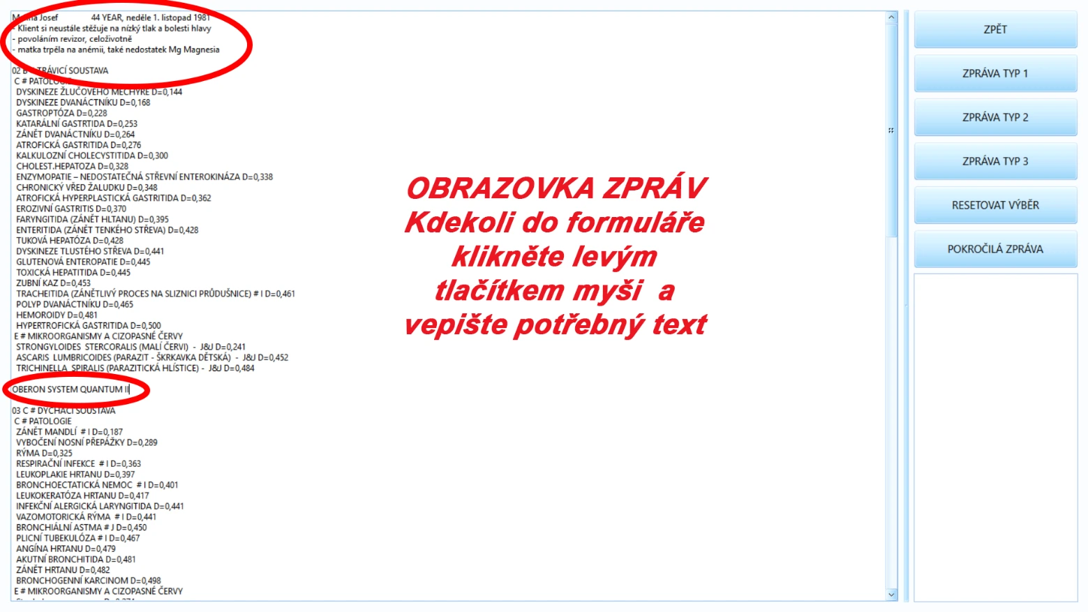 Ukázka postupu v Oberon System Quantum