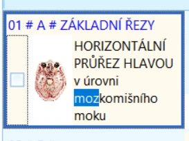 Ukázka postupu v Oberon System Quantum